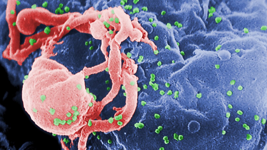 Novedosa terapia podría 'cortar' el VIH de las células infectadas