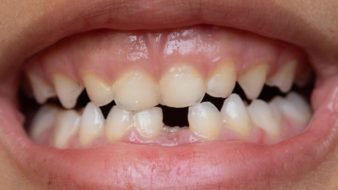 El primer fármaco del mundo para hacer crecer los dientes empezará a ensayarse este año
