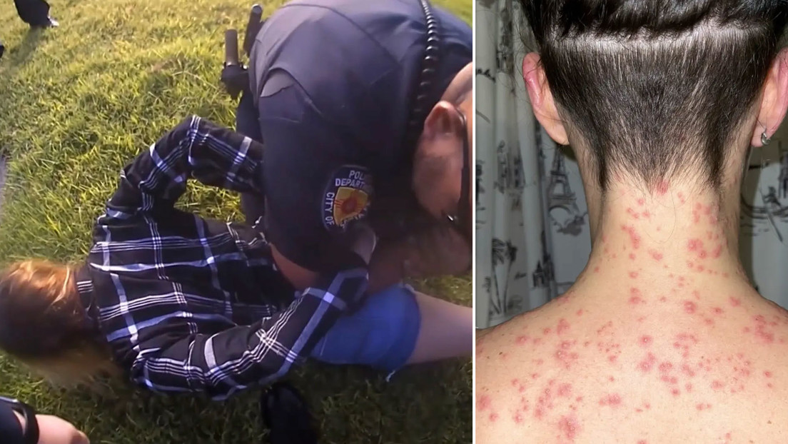 Una mujer denuncia que la Policía la puso cara abajo sobre hormigas rojas durante un arresto