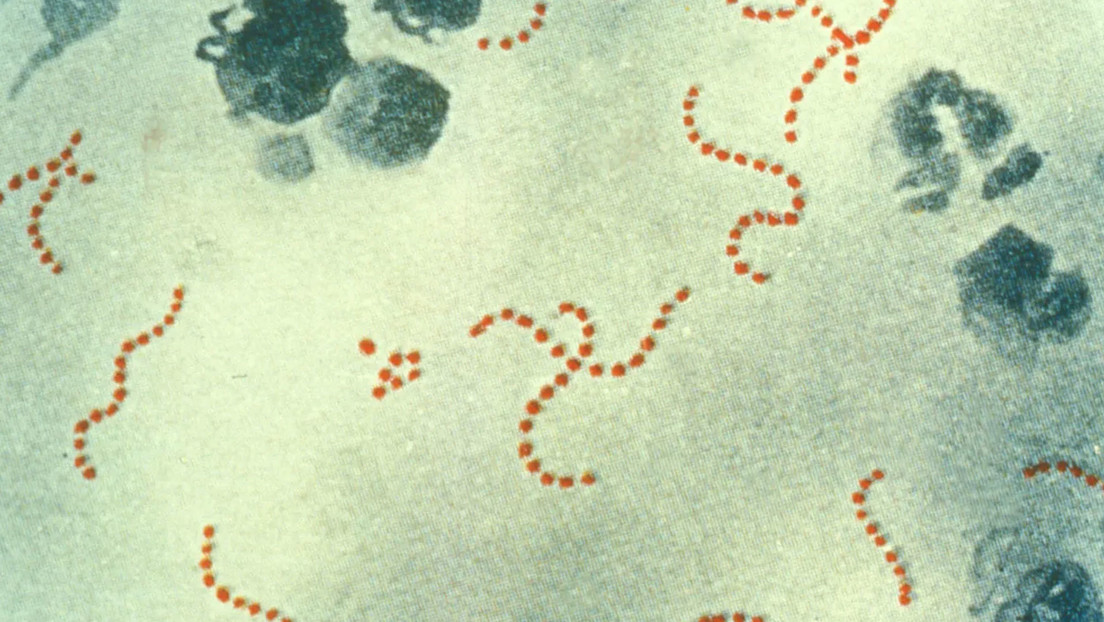 Japón registra cifras récords de infección por un estreptococo 'carnívoro' letal