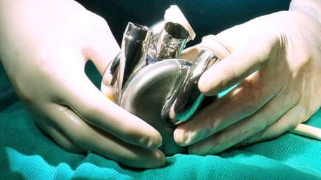 Realizan el primer trasplante de un corazón latente en el mundo-idesotv-noticias-ica Implantan en un paciente el primer corazón artificial de larga duración del mundo