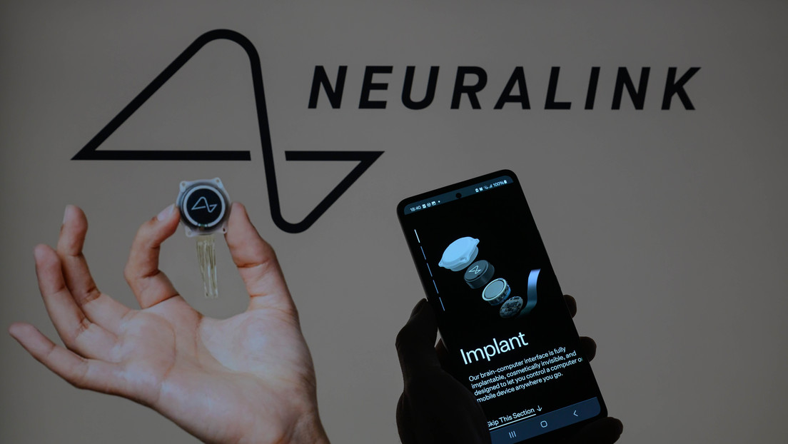 Neuralink probará si su chip cerebral puede controlar un brazo robótico