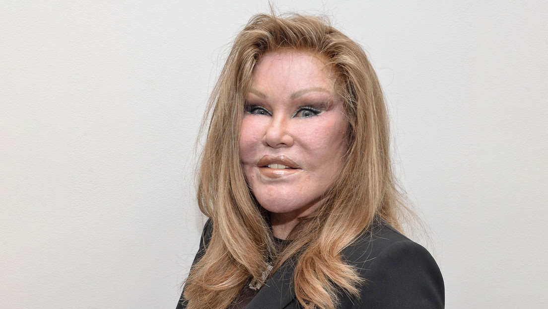 Muere Jocelyn Wildenstein, ampliamente conocida como 'Catwoman'