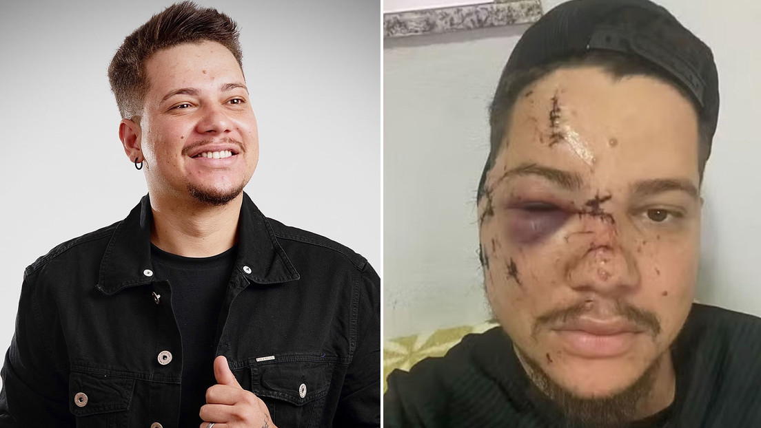 Un cantante brasileño recibe 32 puntos en la cara tras ser golpeado con una botella en un concierto