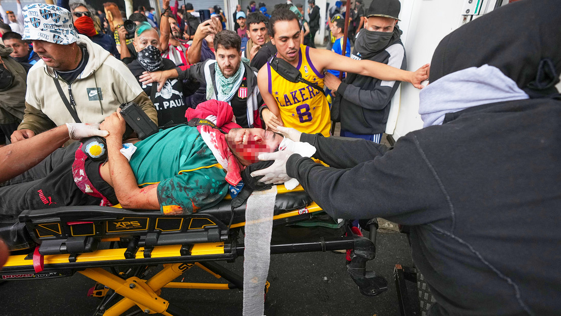 FUERTES IMÁGENES: La Policía de Argentina fractura el cráneo a un fotoperiodista