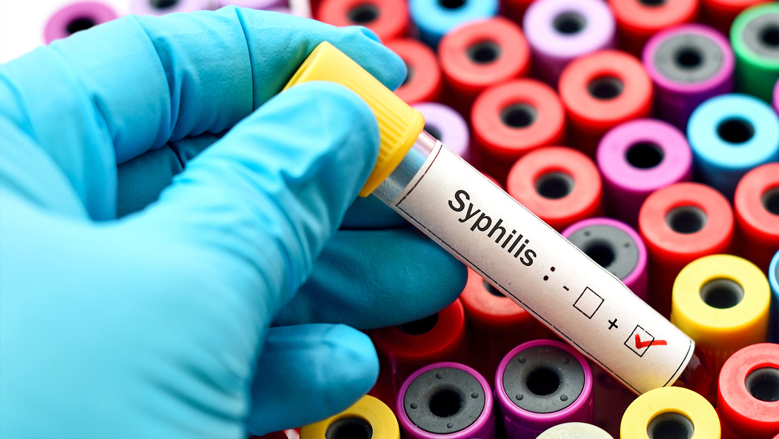 Un país europeo registra récord de infecciones por sífilis