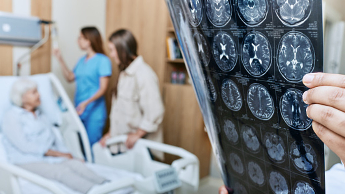 Descubren que una afección común podría ser un factor de riesgo clave para el Parkinson
