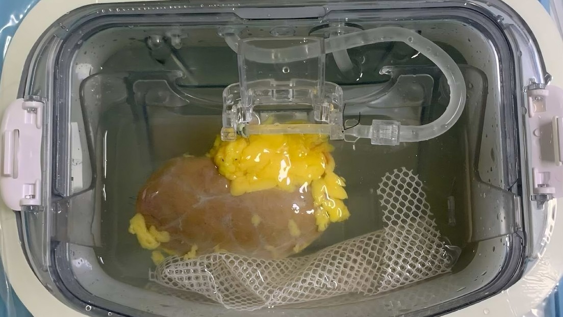 Logran crear un riñón ‘universal’ compatible con cualquier paciente