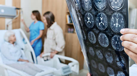 Descubren que una afección común podría ser un factor de riesgo clave para el Parkinson