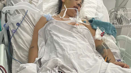 "Desgarrador": Madre de tres hijos en coma inducido tras cirugía estética