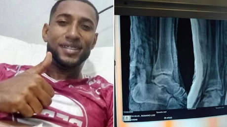 ATERRADORA FRACTURA: La grave lesión de un futbolista que hizo temblar a sus compañeros (VIDEO)