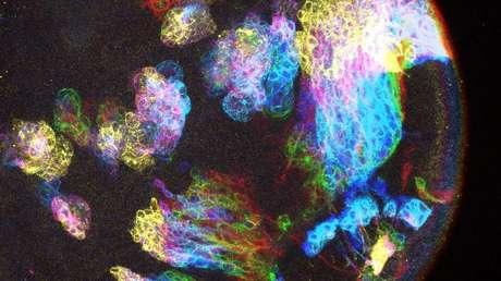 El misterio del cáncer cerebral podría tener una explicación inesperada en el cerebro