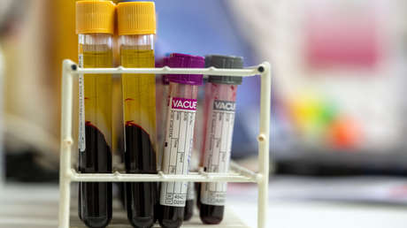 Una nueva prueba de sangre ofrece "una esperanza real" frente a cánceres difíciles de detectar