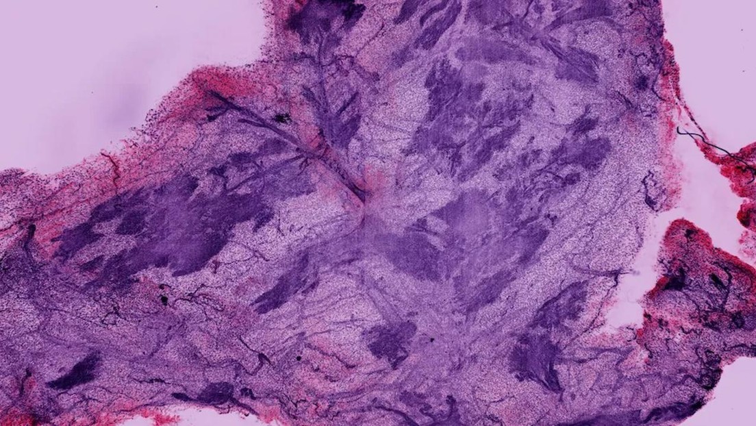 Nueva tecnología de microscopía permite observar tejidos con mayor detalle y menor costo