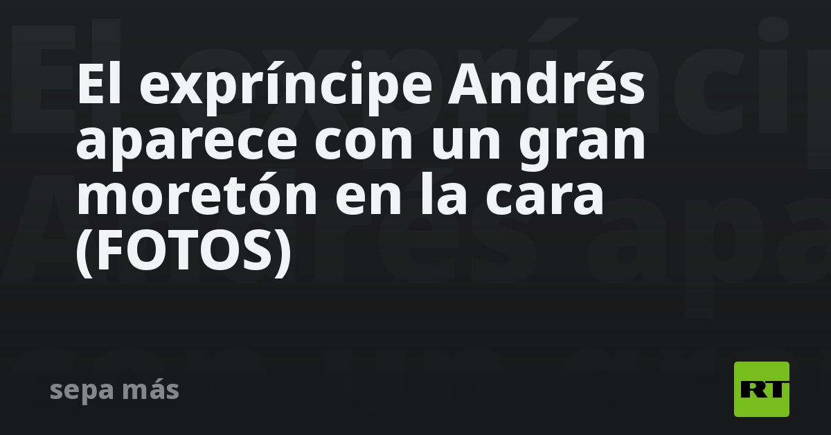 El expríncipe Andrés aparece con un gran moretón en la cara (FOTOS)