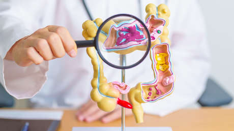 La combinación de estos dos nutrientes multiplica las defensas naturales del colon contra el cáncer