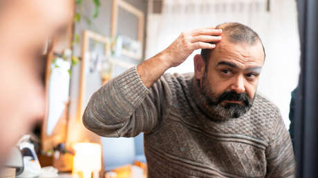¿Por qué el tratamiento contra la caída del cabello no funciona igual en todas las personas?