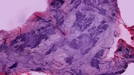 Este avance en microscopía deja ver lo que antes e