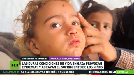 Las duras condiciones de vida en Gaza provocan epidemias y agravan el sufrimiento de los niños