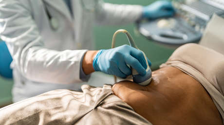 "Creo que me salvó la vida": el sorpresivo diagnóstico que rescató a una mujer de un agresivo cáncer
