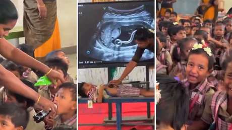 VIDEO: El perturbador método con ecografía de gusanos para alejar a los niños de la comida chatarra