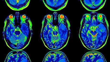 Científicos logran "leer" el cerebro y reconstruir lo que vemos