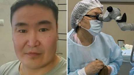 Extraen a un paciente una semilla que echó raíces en su ojo