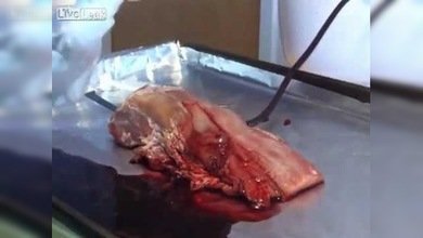 Crean un gel revolucionario que detiene al instante las hemorragias