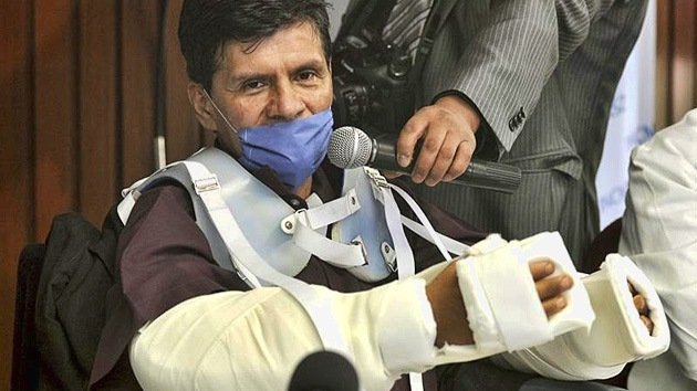 México realiza su primer trasplante de brazos
