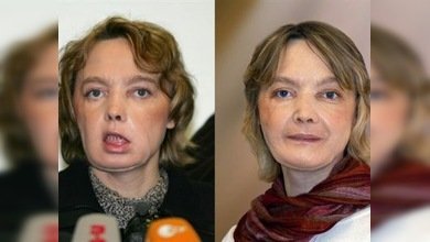 Se cumplen cinco años del primer trasplante parcial de cara exitoso 