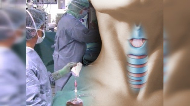 Un trasplante de tráquea creada artificialmente salva a un paciente en estado terminal