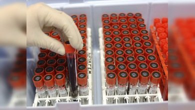 Hay suficiente sangre para los heridos en los hospitales de Moscú