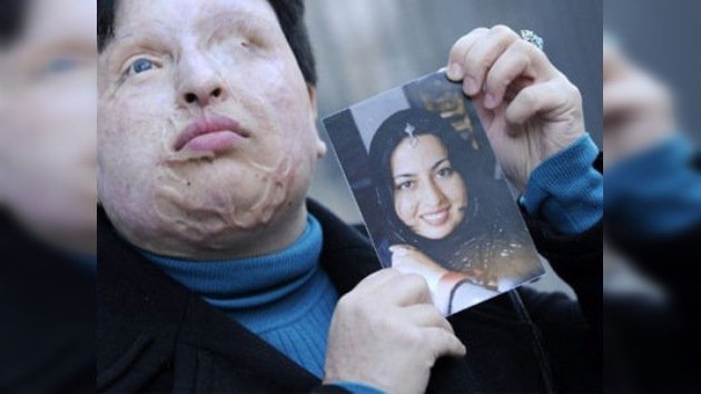 Aplazan la sentencia del hombre que desfiguró a una mujer con ácido en Irán