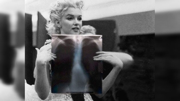 Venden radiografías de Marilyn Monroe en 45,000 dólares