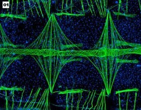 Ganadores del Concurso de Microfotografía 'Micromundo'