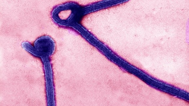 Hay más posibilidades de morir por caerse de la cama que a causa del ébola en EE.UU.