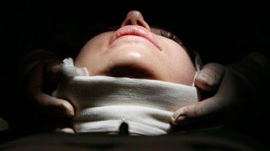 Niñas bajo el bisturí: la obsesión por las cirugías plásticas en Argentina