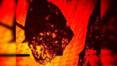 Un nuevo microscopio con hologramas que detecta bacterias