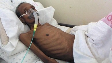 Un brote de tuberculosis resistente a todos los medicamentos se propaga por Sudáfrica