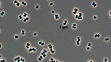 Descubren un nuevo microorganismo superresistente en dos bases espaciales