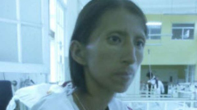 Una indígena peruana que pensaba que estaba embrujada tenía sida