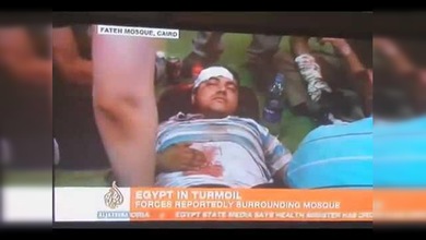 Un manifestante parece fingir una herida de bala cuando es atendido