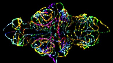 Las mejores microfotos del 2012: arañas bebé, embrión de pez-cebra y célula de cáncer óseo