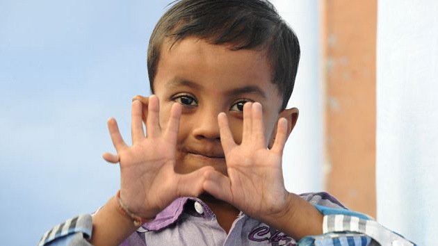 India: Un niño con 25 dedos se convierte en una celebridad en su pueblo