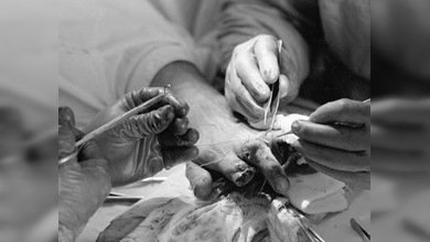 El milagro de la microcirugía rusa