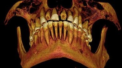 Caries, la otra 'plaga' de Egipto: hallan una momia de hace 2.100 años con empastes