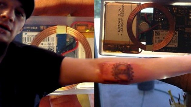 Con la informática a flor de piel: un joven de EE.UU. se implanta un chip en el brazo