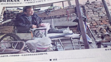 Un hombre se amputa una pierna en China por falta de recursos