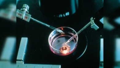 Un test ocular podría detectar de forma precoz el Alzheimer