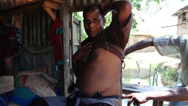 Bangladesíes pobres se ven obligados a vender órganos para pagar sus deudas
